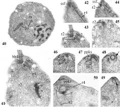 Attēlu rezultāti vaicājumam “Arcyria cinerea”