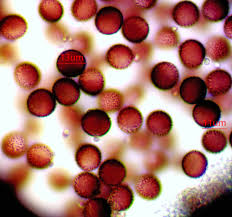 Attēlu rezultāti vaicājumam “Physarum penetrale stalked”