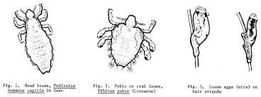 Attēlu rezultāti vaicājumam “Pediculus humanus capitis”