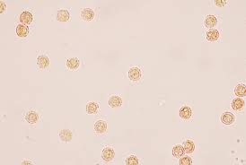 Attēlu rezultāti vaicājumam “Lycogala sp.”