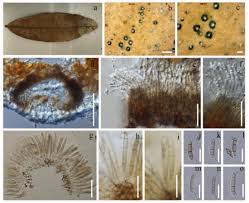 Attēlu rezultāti vaicājumam “Rhytidiadelphus subpinnatus sporophyte”