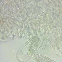 Attēlu rezultāti vaicājumam “Melanospora lagenaria”