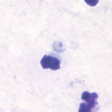 Attēlu rezultāti vaicājumam “undetermined plasmodium”