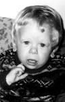 in Williams syndrome.
