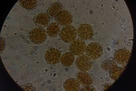 Attēlu rezultāti vaicājumam “Trachyspora intrusa”