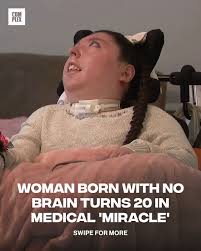 Image result for no brain