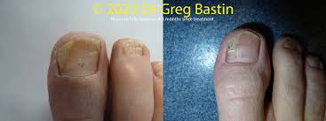 Image result for lunula nail