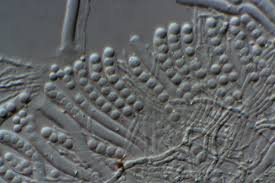 Attēlu rezultāti vaicājumam “Caloscypha fulgens”