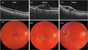 「pvAj[MjA」の画像検索結果