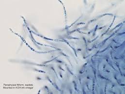 Attēlu rezultāti vaicājumam “Hypoxylon fuscum”