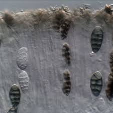 Attēlu rezultāti vaicājumam “Diachea muscorum spores”