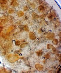 Attēlu rezultāti vaicājumam “Lycogala succineum sessile”