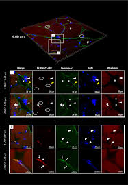 Image result for Orrell Red Triangle Cc