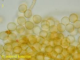 Attēlu rezultāti vaicājumam “Trichia contorta macro”