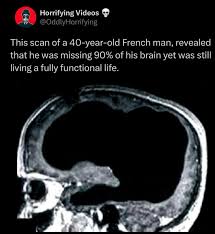 Image result for no brain