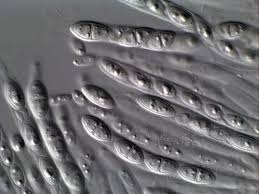 Attēlu rezultāti vaicājumam “Hypocreopsis lichenoides”