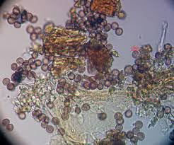 Attēlu rezultāti vaicājumam “Physarum pseudoalexandrowiczii”