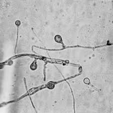 Attēlu rezultāti vaicājumam “Trichia longipalpis spores”