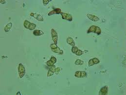 Attēlu rezultāti vaicājumam “Cephaloziella elachista macro”