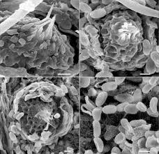 Attēlu rezultāti vaicājumam “Melampsoridium sp.”