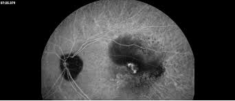 「pvAj[MjA」の画像検索結果