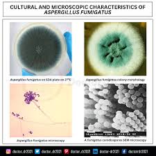 Attēlu rezultāti vaicājumam “Octosporella jungermanniarum”