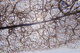 Attēlu rezultāti vaicājumam “Stemonitis fusca spores”