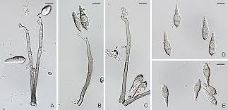 Attēlu rezultāti vaicājumam “Pylaisia polyantha sporophyte”