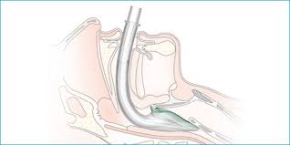 Image result for Igel