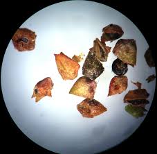 Attēlu rezultāti vaicājumam “Atriplex patula fruit”