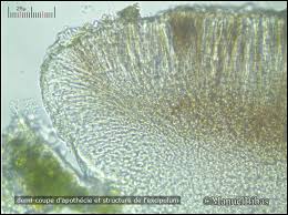 Attēlu rezultāti vaicājumam “Bilimbia tetramera”