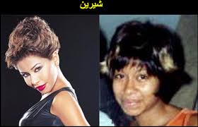 صور فضايح الفنانين قبل عمليات التجميل Images?q=tbn:ANd9GcQ5fYwuvapZt3QjPK8IHMAYD6Will5oxIgXb3EorRbXPiD8zq2h0g