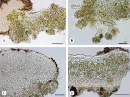 Attēlu rezultāti vaicājumam “Candelariella sp.”