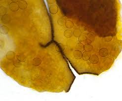 Attēlu rezultāti vaicājumam “Licea testudinacea spores”