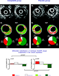 Effects of the Direct Lipoprotein-Associated Phospholipase A2 ...