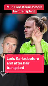 Image result for Liverpool Transplant FC