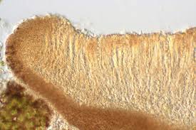 Attēlu rezultāti vaicājumam “Trapeliopsis granulosa”