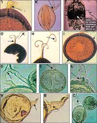 Attēlu rezultāti vaicājumam “Gulielmina vermicularis spores”