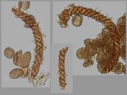 Attēlu rezultāti vaicājumam “Licea testudinacea spores”