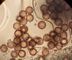 Attēlu rezultāti vaicājumam “Diderma ochraceum sessile”