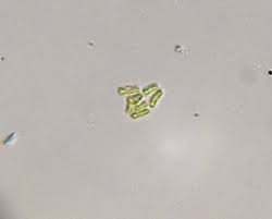 Attēlu rezultāti vaicājumam “Chaenotheca furfuracea”