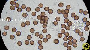 Attēlu rezultāti vaicājumam “Diderma umbilicatum”