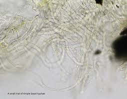 Attēlu rezultāti vaicājumam “Hyalorbilia inflatula”