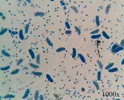 Attēlu rezultāti vaicājumam “Diderma tigrinum spores”