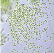 Attēlu rezultāti vaicājumam “Dermatocarpon luridum”