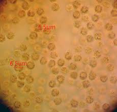 Attēlu rezultāti vaicājumam “Lycogala paraconfusum spores”