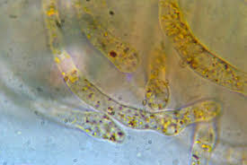 Attēlu rezultāti vaicājumam “Octospora humosa”