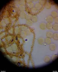 Attēlu rezultāti vaicājumam “Ophiotheca chrysosperma”