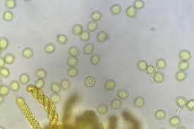 Attēlu rezultāti vaicājumam “Trichia scabra sessile”