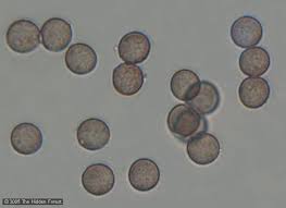 Attēlu rezultāti vaicājumam “Didymium spongiosum spores”